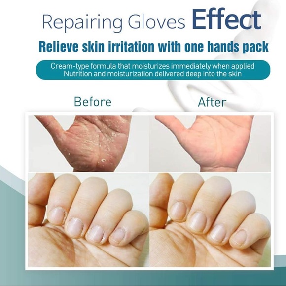 Epielle Intensive Repairing Hand Masks - 6 Pack - Picture 8 of 9